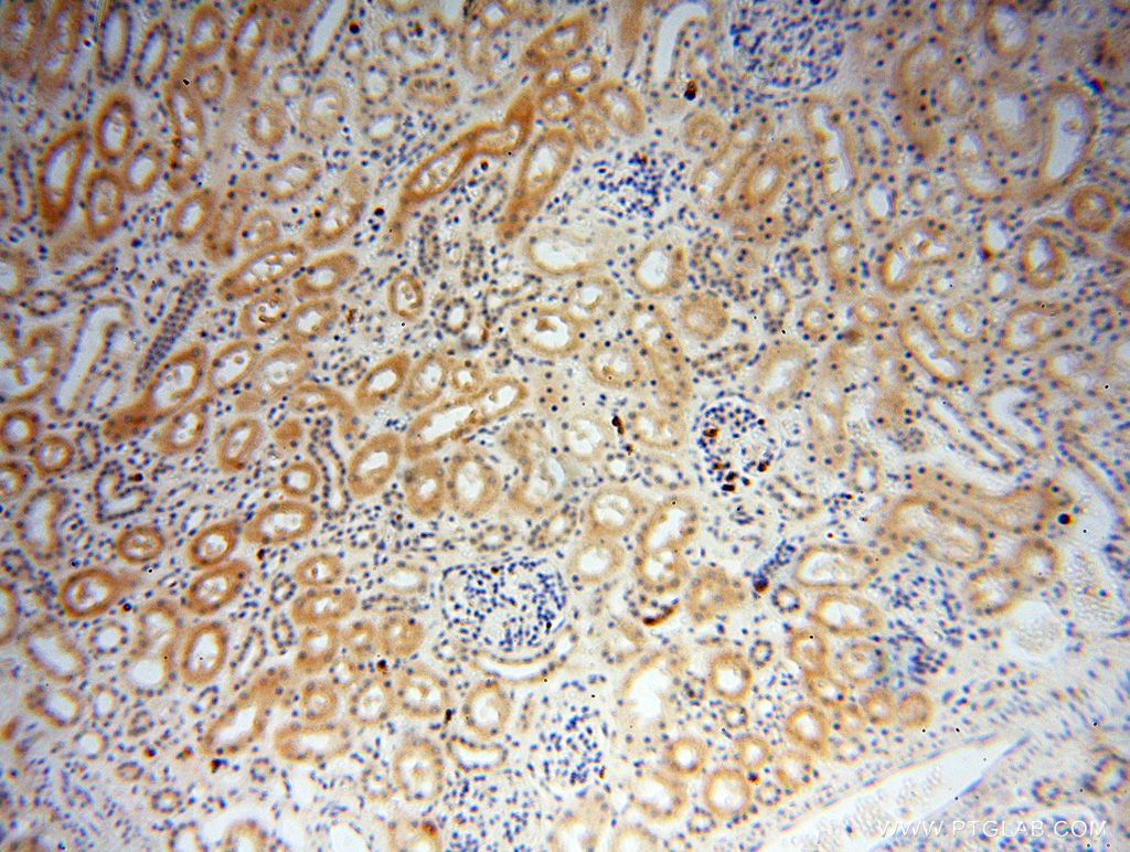 IHC staining of human kidney using 16900-1-AP