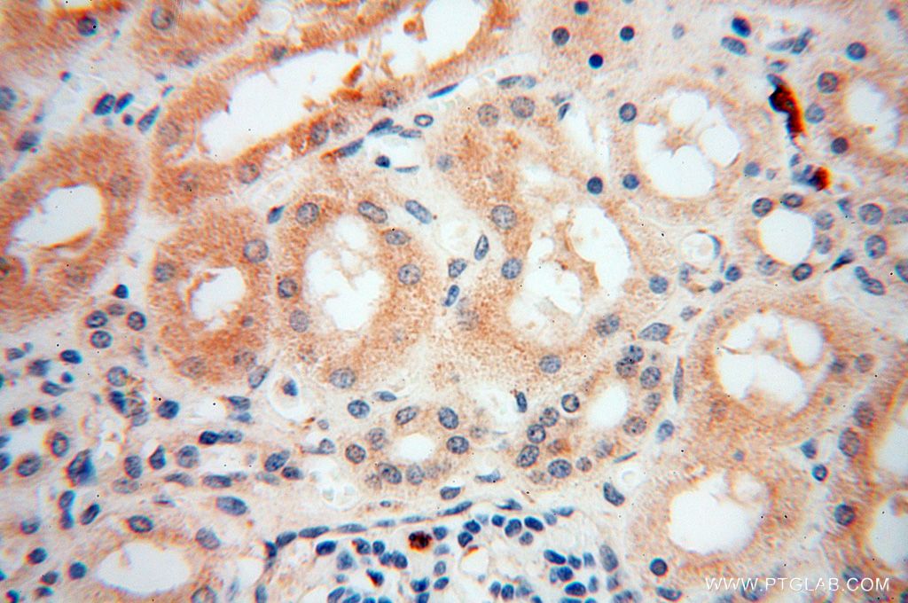 Immunohistochemistry (IHC) staining of human kidney tissue using GALNTL2 Polyclonal antibody (16900-1-AP)