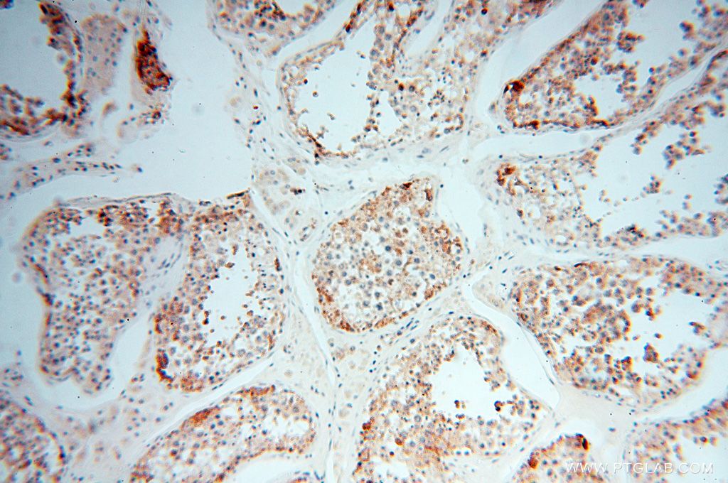 Immunohistochemistry (IHC) staining of human testis tissue using GALNTL2 Polyclonal antibody (16900-1-AP)