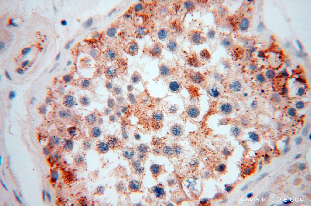 Immunohistochemistry (IHC) staining of human testis tissue using GALNTL2 Polyclonal antibody (16900-1-AP)