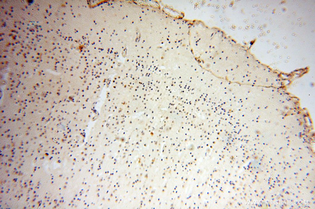 Immunohistochemistry (IHC) staining of human brain tissue using GALNTL2 Polyclonal antibody (16900-1-AP)