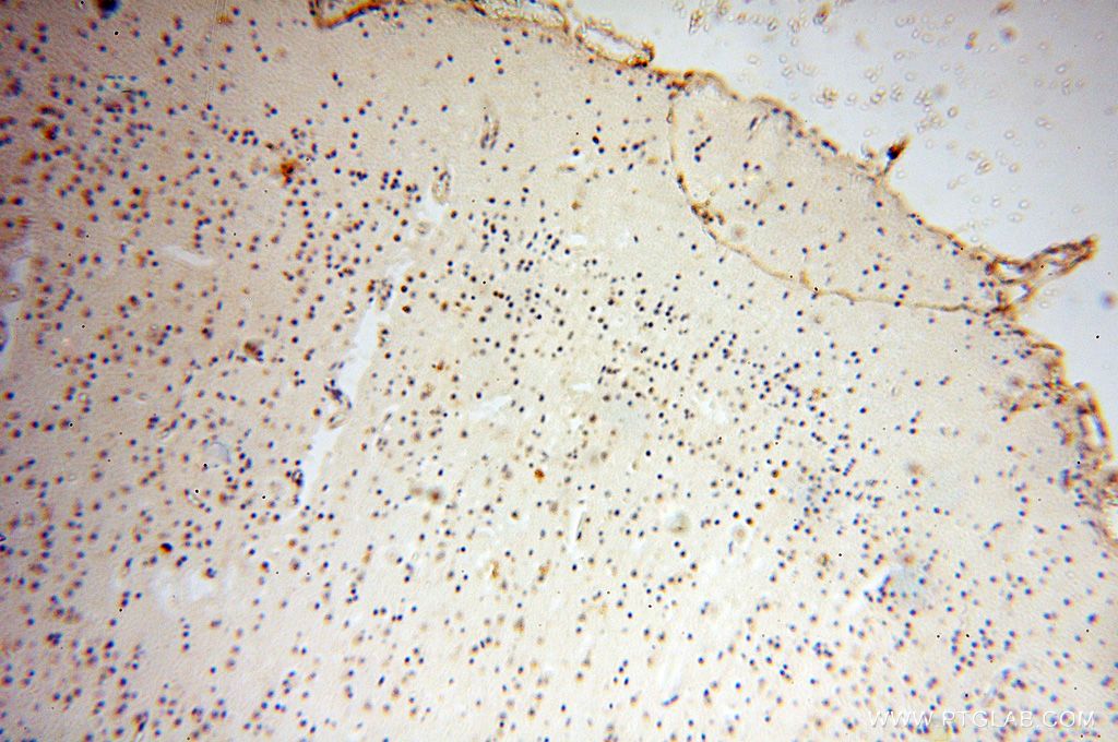 IHC staining of human brain using 16900-1-AP