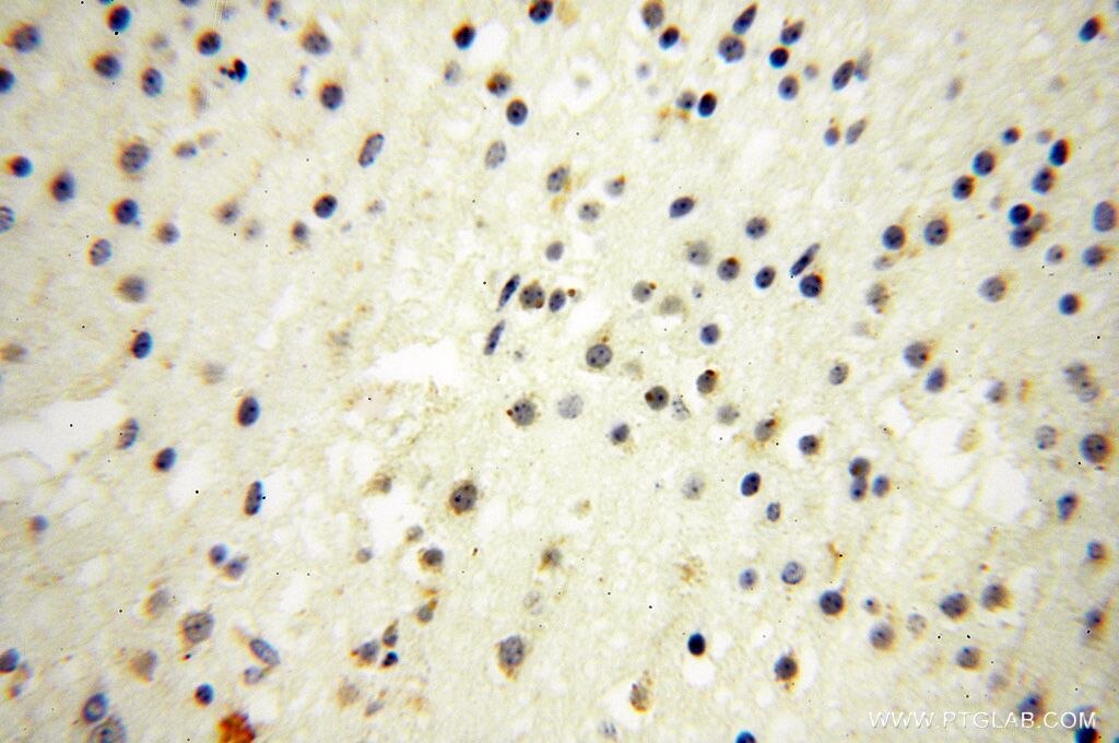 Immunohistochemistry (IHC) staining of human brain tissue using GALNTL2 Polyclonal antibody (16900-1-AP)
