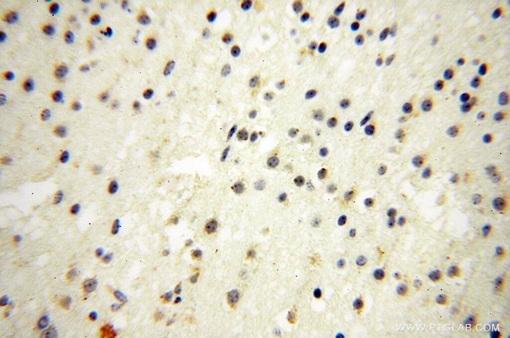 Immunohistochemistry (IHC) staining of human brain tissue using GALNTL2 Polyclonal antibody (16900-1-AP)