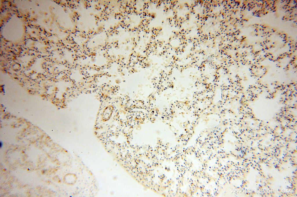 Immunohistochemistry (IHC) staining of human lung tissue using GALNTL2 Polyclonal antibody (16900-1-AP)