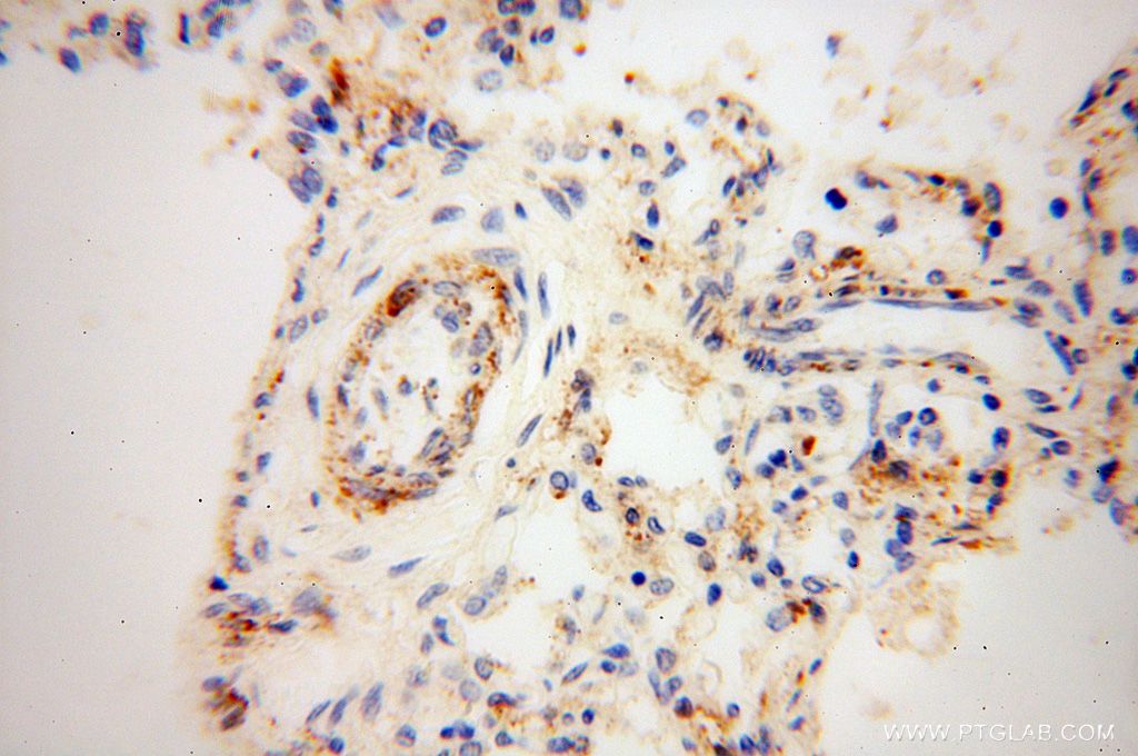 Immunohistochemistry (IHC) staining of human lung tissue using GALNTL2 Polyclonal antibody (16900-1-AP)