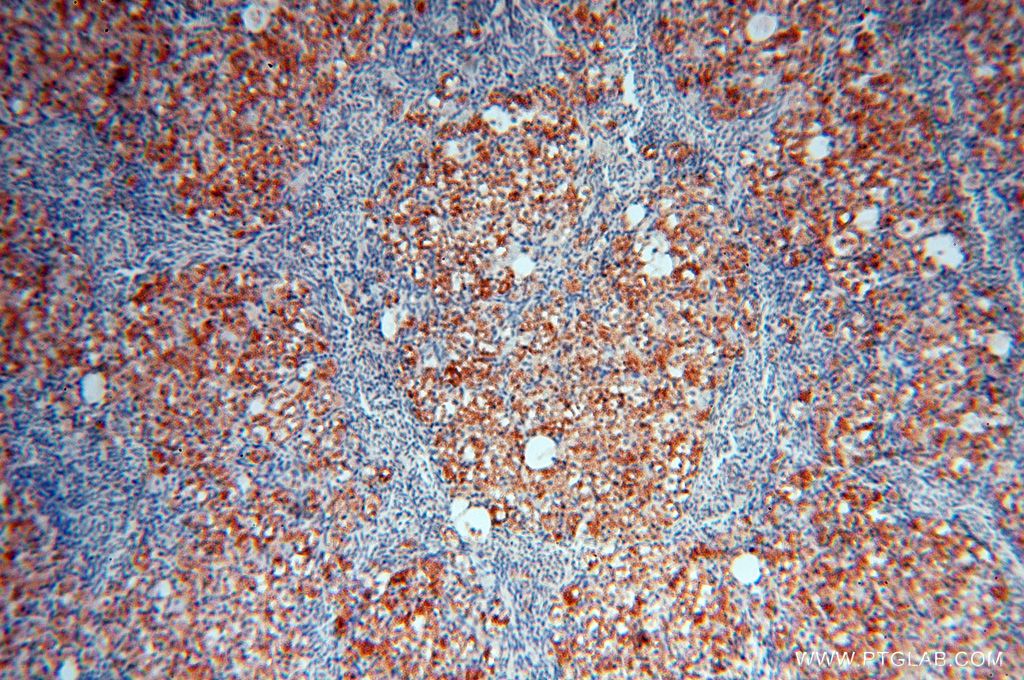 Immunohistochemistry (IHC) staining of human ovary tissue using GALNTL2 Polyclonal antibody (16900-1-AP)