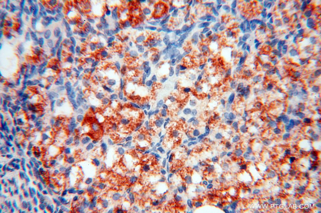 IHC staining of human ovary using 16900-1-AP