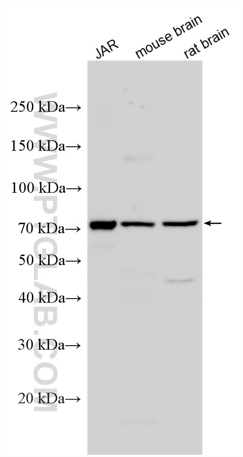 Western Blot (WB) analysis of various lysates using GALNTL2 Polyclonal antibody (16900-1-AP)