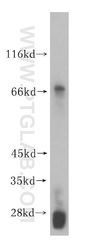 Western Blot (WB) analysis of HEK-293 cells using GALNTL2 Polyclonal antibody (16900-1-AP)