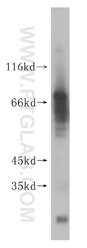 Western Blot (WB) analysis of human liver tissue using GALNTL2 Polyclonal antibody (16900-1-AP)