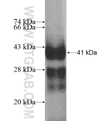 GALNTL2 fusion protein Ag10455 SDS-PAGE