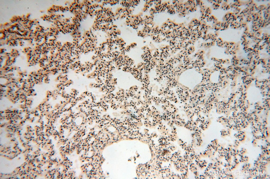 Immunohistochemistry (IHC) staining of human lung tissue using GALNTL5 Polyclonal antibody (17131-1-AP)