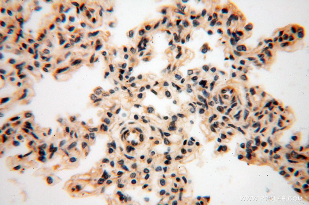Immunohistochemistry (IHC) staining of human lung tissue using GALNTL5 Polyclonal antibody (17131-1-AP)