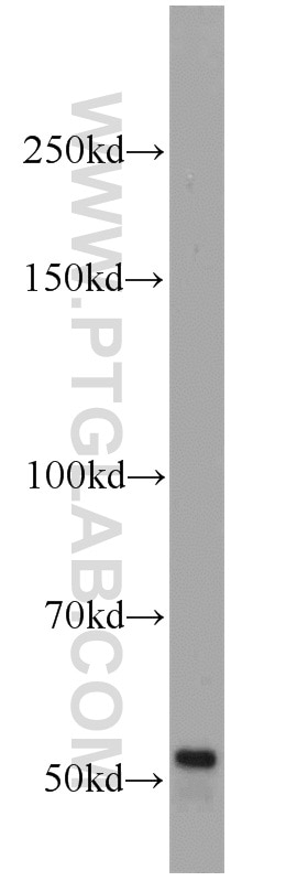 Western Blot (WB) analysis of human placenta tissue using GALNTL5 Polyclonal antibody (17131-1-AP)