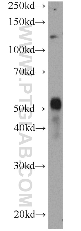 Western Blot (WB) analysis of human testis tissue using GALNTL5 Polyclonal antibody (17131-1-AP)