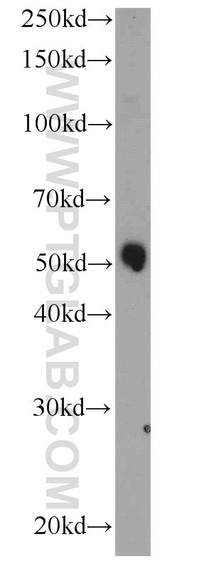 Western Blot (WB) analysis of human placenta tissue using GALNTL5 Polyclonal antibody (17131-1-AP)