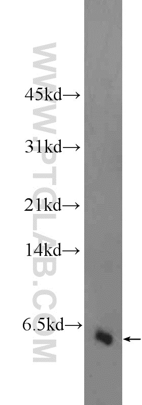 Western Blot (WB) analysis of fetal human brain tissue using GALP Polyclonal antibody (25116-1-AP)