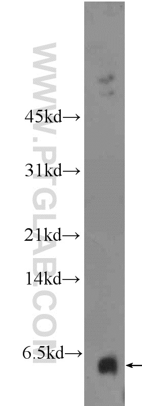 WB analysis of SH-SY5Y using 25116-1-AP