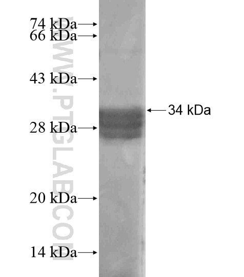 GALP fusion protein Ag18928 SDS-PAGE