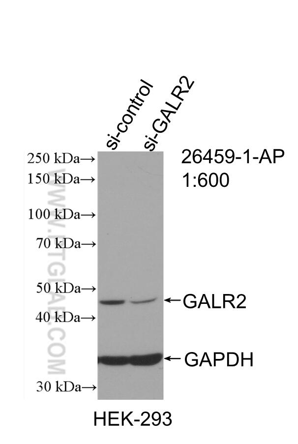 Western Blot (WB) analysis of HEK-293 cells using GALR2 Polyclonal antibody (26459-1-AP)