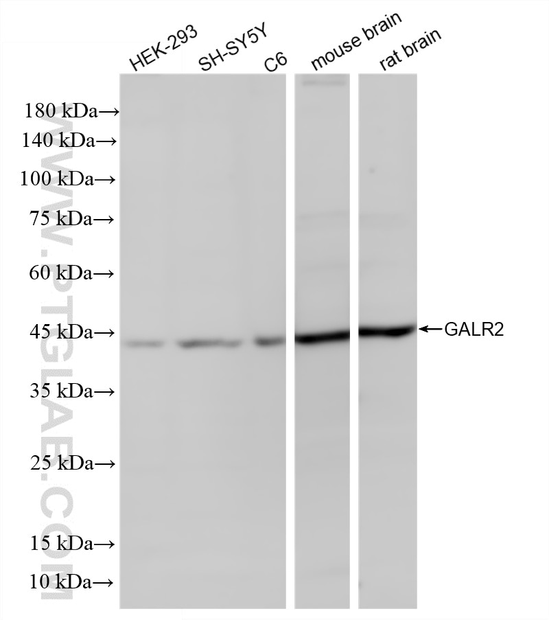 Western Blot (WB) analysis of various lysates using GALR2 Recombinant monoclonal antibody (87015-1-RR)