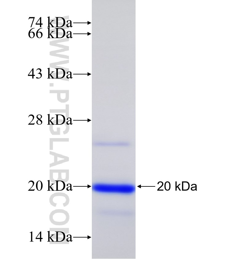 GALR2 fusion protein Ag31762 SDS-PAGE