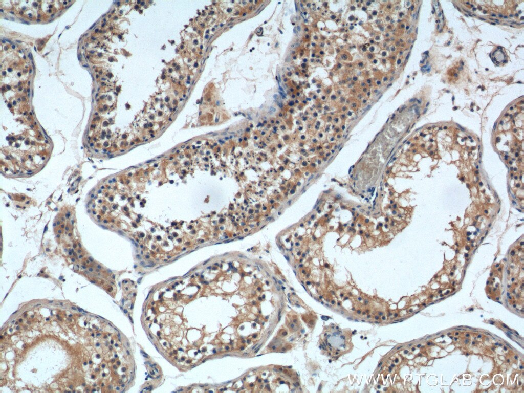 Immunohistochemistry (IHC) staining of human testis tissue using GALR3 Polyclonal antibody (20009-1-AP)