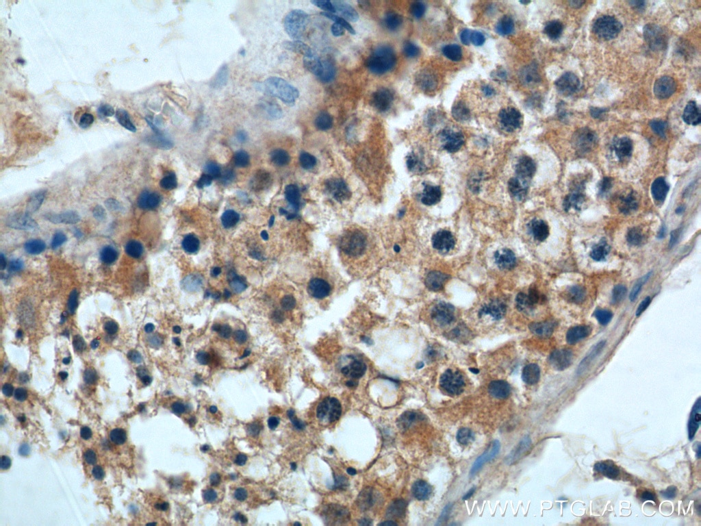Immunohistochemistry (IHC) staining of human testis tissue using GALR3 Polyclonal antibody (20009-1-AP)