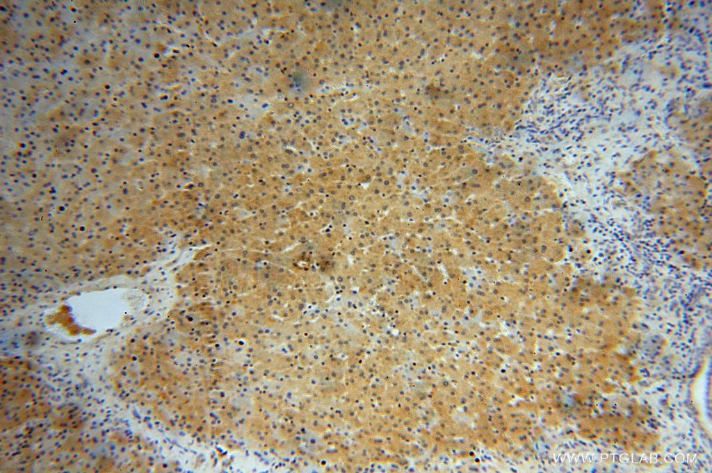 Immunohistochemistry (IHC) staining of human liver tissue using GALT Polyclonal antibody (17035-1-AP)