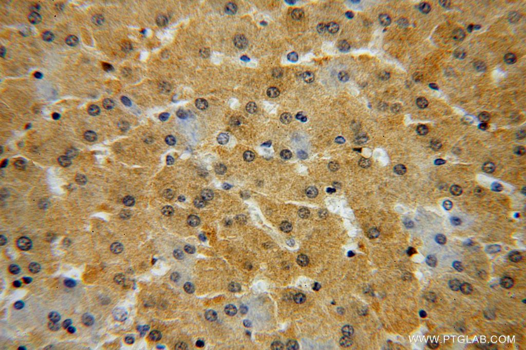 Immunohistochemistry (IHC) staining of human liver tissue using GALT Polyclonal antibody (17035-1-AP)