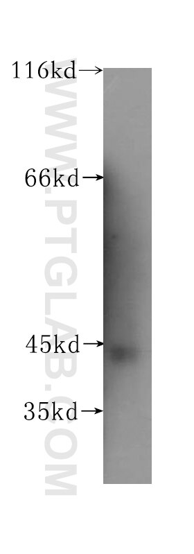 Western Blot (WB) analysis of human liver tissue using GALT Polyclonal antibody (17035-1-AP)