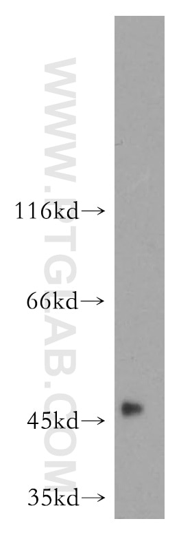 Western Blot (WB) analysis of human liver tissue using GALT Polyclonal antibody (17035-1-AP)