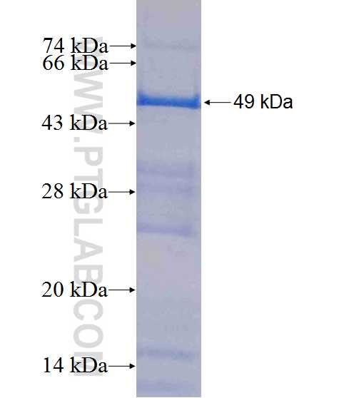 GALT fusion protein Ag10488 SDS-PAGE