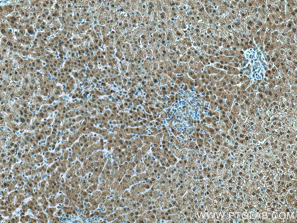 Immunohistochemistry (IHC) staining of human liver tissue using GAMT Polyclonal antibody (10880-1-AP)