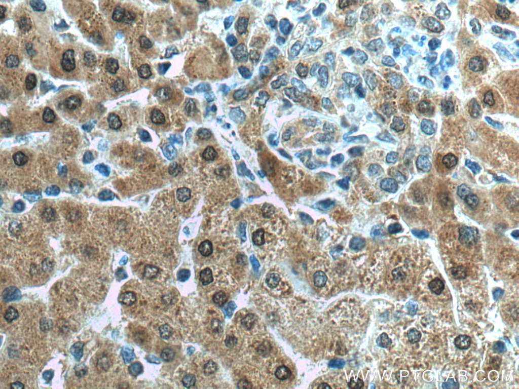 Immunohistochemistry (IHC) staining of human liver tissue using GAMT Polyclonal antibody (10880-1-AP)