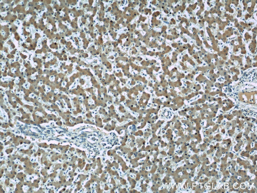 Immunohistochemistry (IHC) staining of human liver tissue using GAMT Polyclonal antibody (10880-1-AP)