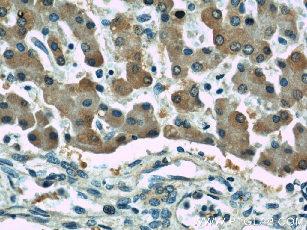 Immunohistochemistry (IHC) staining of human liver tissue using GAMT Polyclonal antibody (10880-1-AP)