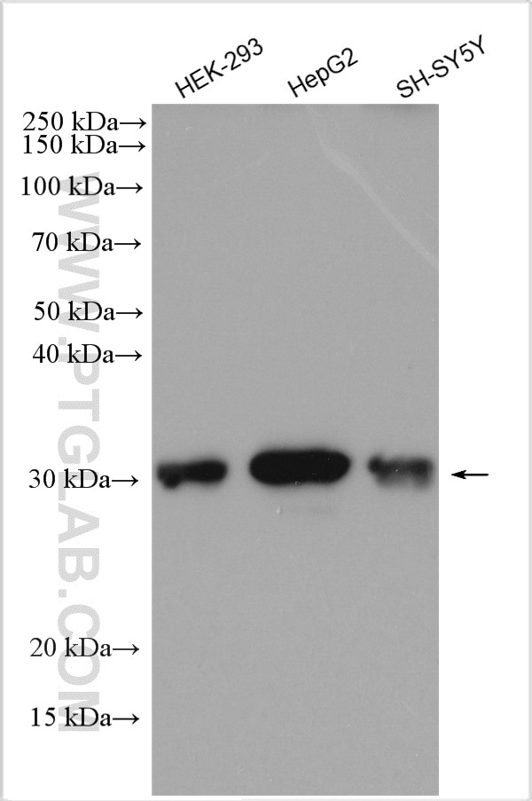 Western Blot (WB) analysis of various lysates using GAMT Polyclonal antibody (10880-1-AP)