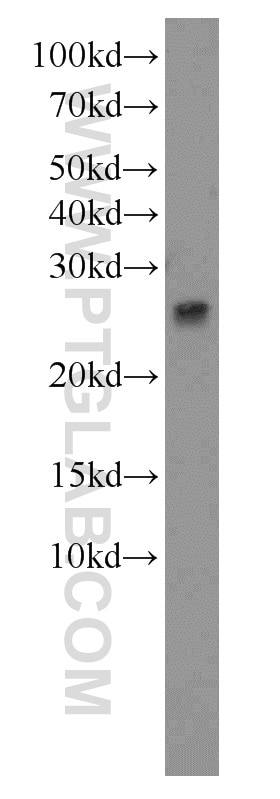 WB analysis of rat liver using 10880-1-AP