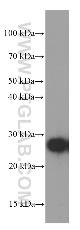 Western Blot (WB) analysis of fetal human brain tissue using GAMT Monoclonal antibody (66322-1-Ig)