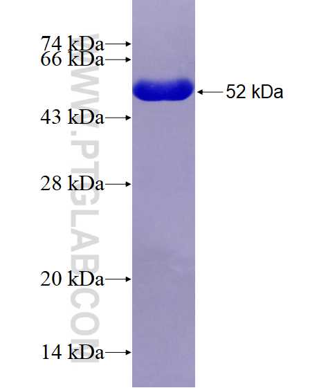 GAMT fusion protein Ag1327 SDS-PAGE