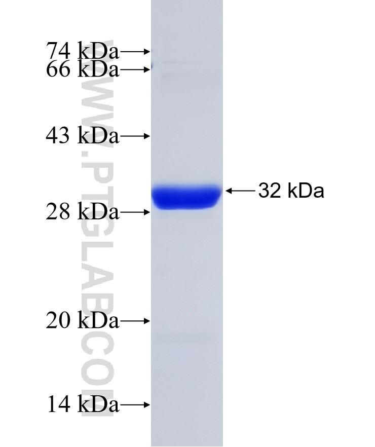 GAMT fusion protein Ag16778 SDS-PAGE