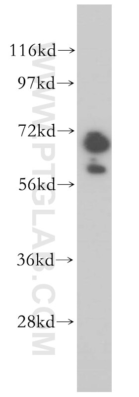 Western Blot (WB) analysis of mouse brain tissue using GAN Polyclonal antibody (14305-1-AP)