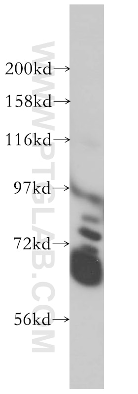 Western Blot (WB) analysis of HEK-293 cells using GAN Polyclonal antibody (14305-1-AP)