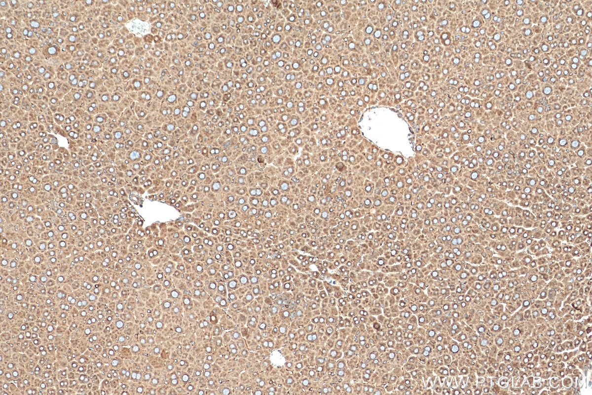 Immunohistochemistry (IHC) staining of mouse liver tissue using GANAB Polyclonal antibody (29183-1-AP)