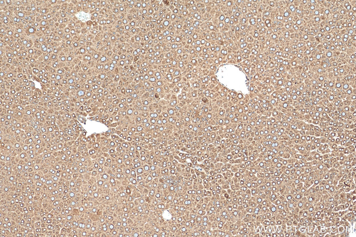 Immunohistochemistry (IHC) staining of mouse liver tissue using GANAB Polyclonal antibody (29183-1-AP)
