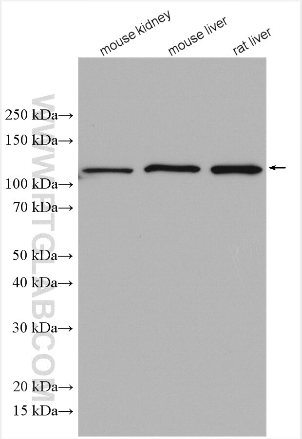 Western Blot (WB) analysis of various lysates using GANAB Polyclonal antibody (29183-1-AP)