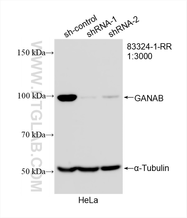 Western Blot (WB) analysis of HeLa cells using GANAB Recombinant antibody (83324-1-RR)