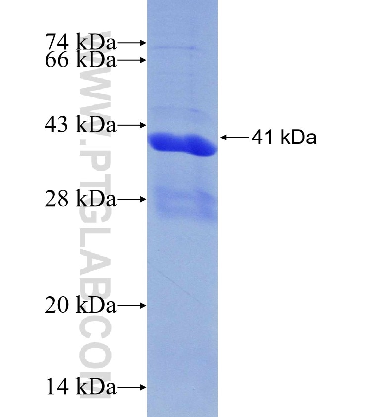 GANAB fusion protein Ag30417 SDS-PAGE